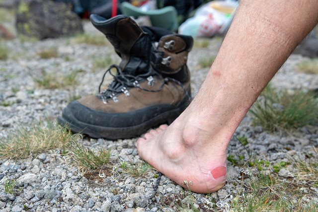 Pantoffels Slippers Wat Draag Je Na Het Wandelen: Blaar voet